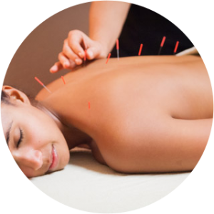 Raleigh Acupuncturist